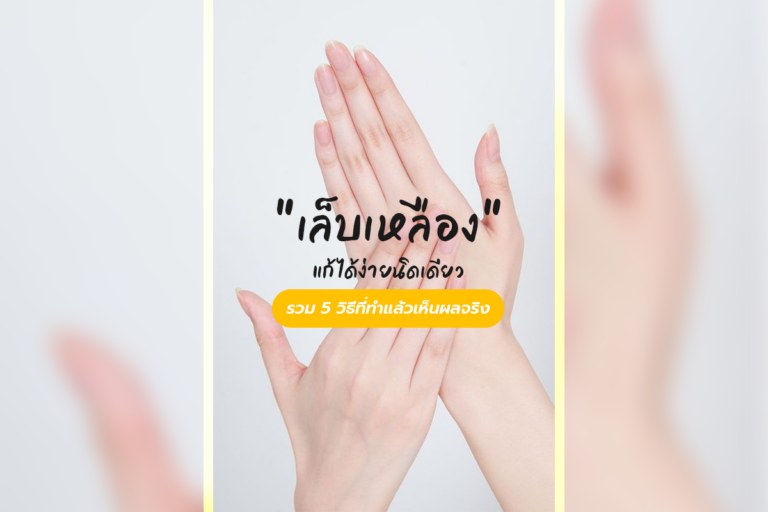 “เล็บเหลือง” แก้ได้ง่ายนิดเดียว รวม 5 วิธีที่ทำแล้วเห็นผลจริง