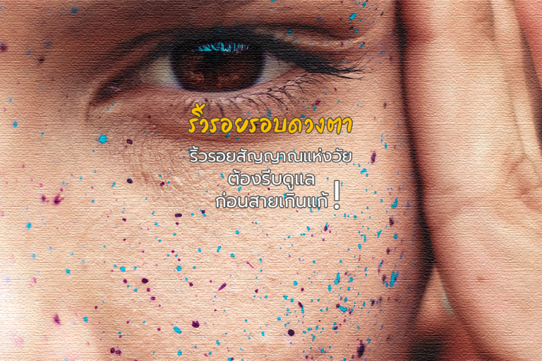 ริ้วรอยรอบดวงตา ริ้วรอยสัญญาณแห่งวัย รีบดูแลก่อนสายเกินแก้!