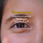 eye banner