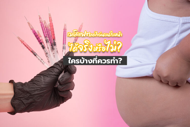 เมโสแฟต ลดไขมันบนหน้าได้จริงหรือไม่ ใครบ้างที่ควรทำ?