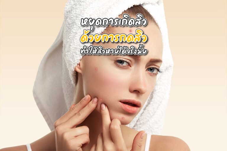 หยุดการเกิดสิวด้วย การกดสิว ทำให้สิวหายได้จริงมั้ย?