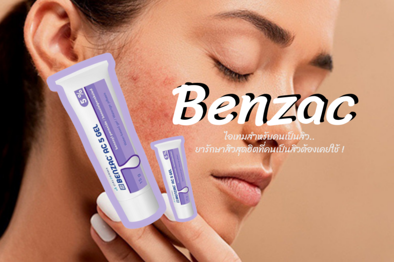 Benzac ไอเทมสำหรับคนเป็นสิว.. ยารักษาสิวสุดฮิตที่คนเป็นสิวต้องเคยใช้ !