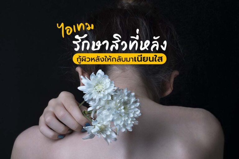 ไอเทมรักษาสิวที่หลัง กู้ผิวหลังให้กลับมาเนียนใส !
