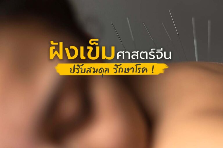 ฝังเข็มศาสตร์จีน ศาสตร์แห่งความสมดุล ปรับสมดุล ! รักษาโรค !