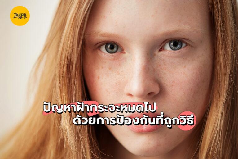 ปัญหาฝ้ากระ จะหมดไป ด้วยการป้องกันที่ถูกวิธี