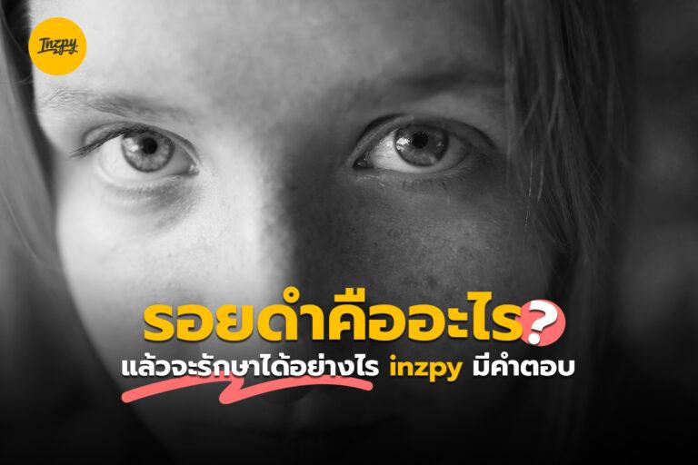 รอยดำ คืออะไร? แล้วจะรักษาได้อย่างไร? inzpy มีคำตอบ