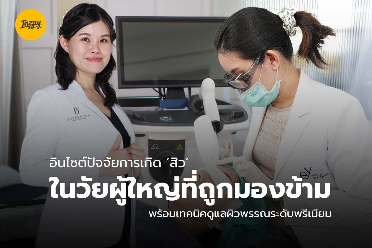 สิวในวัยผู้ใหญ่